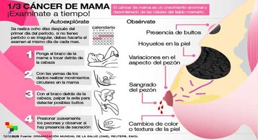 cáncer