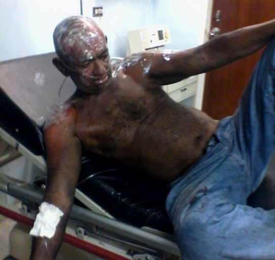 Vigilante herido Zulia